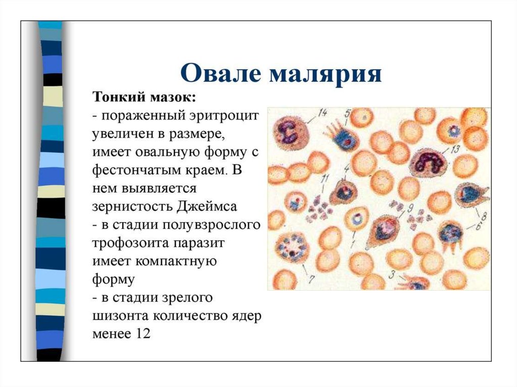 Изменение свойств эритроцитов при тропической малярии. Малярия шизонт. Четырехдневная малярия мазок крови. Мазок крови больного малярией.