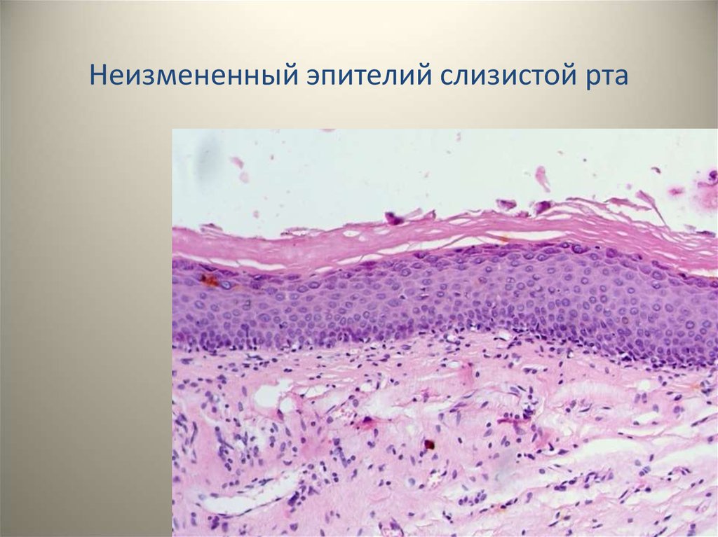 Клетки слизистой полости рта. Многослойный эпителий ротовой полости. Микропрепарат эпителий полости рта. Эпителий слизистой оболочки полости рта микропрепарат. Многослойный плоский эпителий слизистой оболочки полости.
