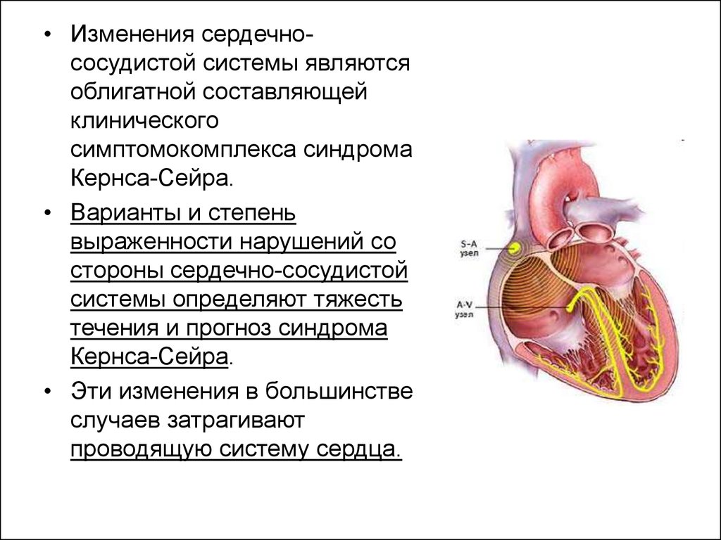 Сердечные изменения. Синдром Кернса-Сейра частота встречаемости. KSS синдром Кернса Сейра частота встречаемости. Кернса Сейра патогенез. Гастроэнтероколитический вариант изменения со стороны ССС.