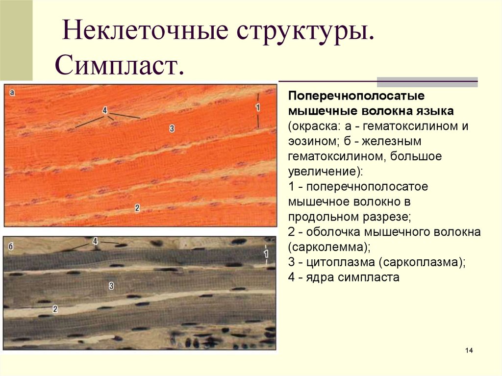 Какими буквами обозначены изображения поперечнополосатой мышечной ткани. Симпласт поперечно полосатое мышечное волокно гистология. Препарат Симпласт поперечно полосатое мышечное волокно. Мышечное волокно Симпласт гистология. Симпласт гистология препарат.