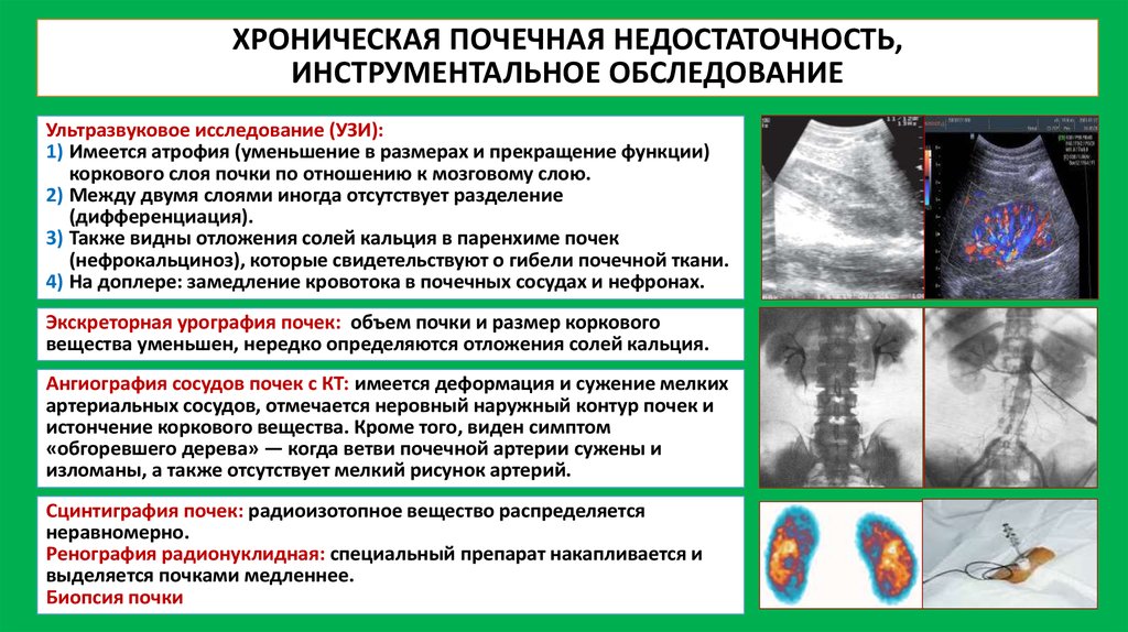 Для ультразвуковой картины почек при остром гломерулонефрите будет характерно