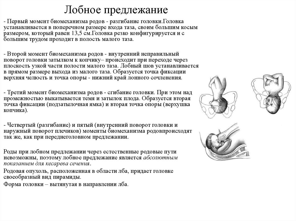 Предлежание в малом тазу. Лобное предлежание биомеханизм. Головное предлежание плода биомеханизмы. Биомеханизм родов при лобном предлежании. Механизм родов при лобном предлежании.