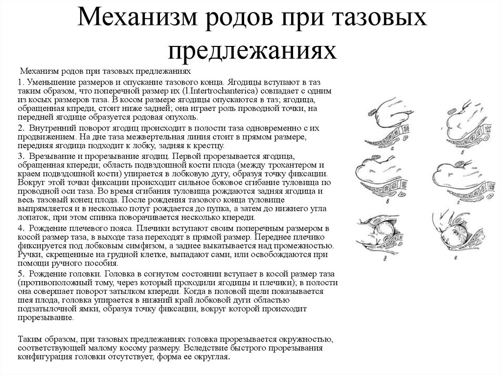 Родоразрешение при предлежании. Механизм родов при тазовом предлежании. Механизм родов при тазовом предлежании плода. Тазовое предлежание плода биомеханизм родов. Роды при тазовом предлежании. Биомеханизм родов..