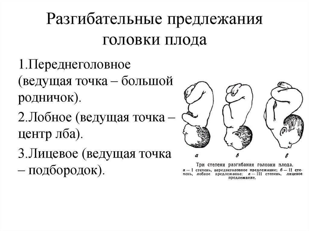 Головное положение. Разгибательные предлежания плода диагностика. Разгибательные предлежания головки: классификация. Клинические рекомендации разгибательные предлежания. Механизм родов при разгибательных предлежаниях головки.