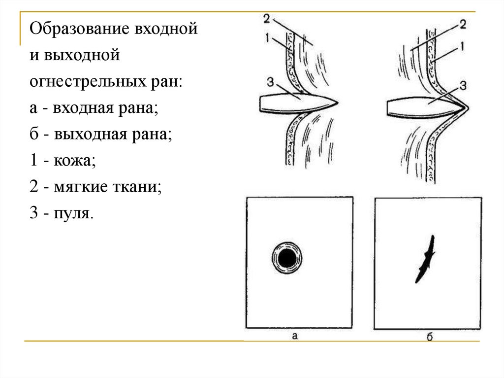 Направление выстрела. Входное отверстие и раневой канал. Признаки входного отверстия огнестрельного повреждения. Входное отверстие раневого канала при огнестреле. Входная и выходная рана огнестрельная.