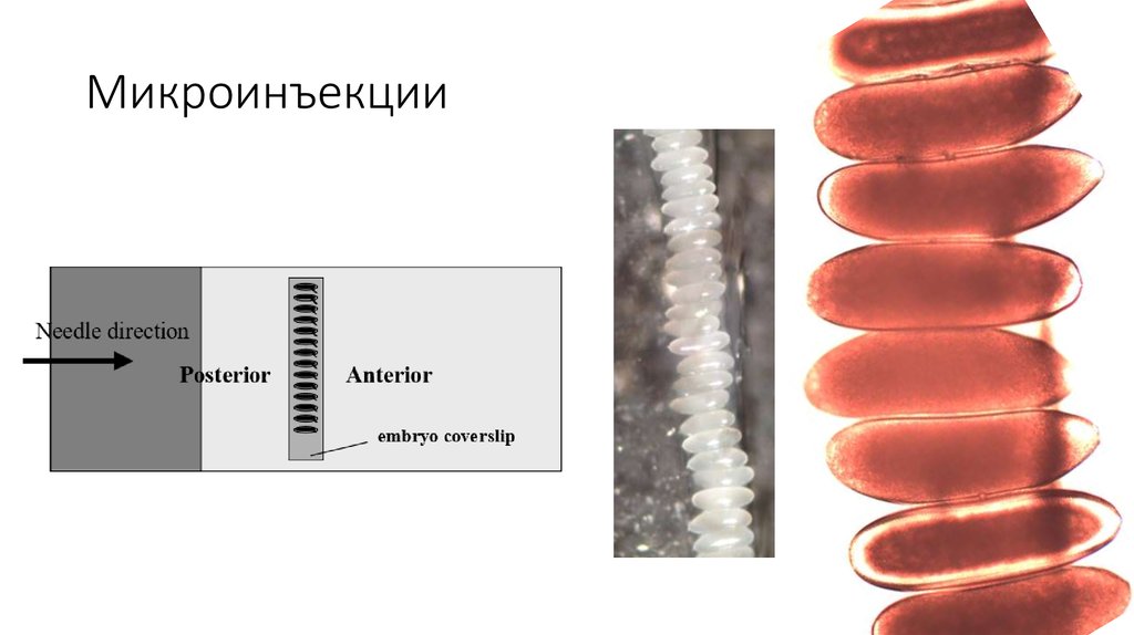 Микроинъекции