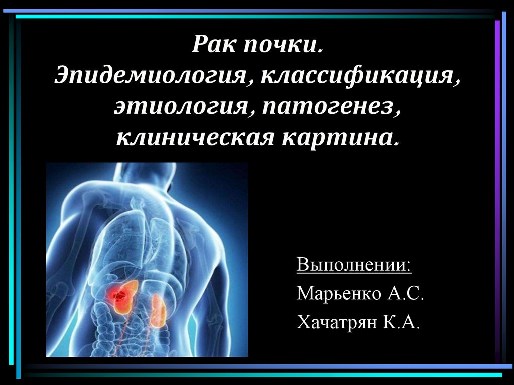 Рак почки. Опухоли почек этиология. Патогенез опухоли почки. Эпидемиология карцинома почки. Опухоли почки эпидемиология классификация.