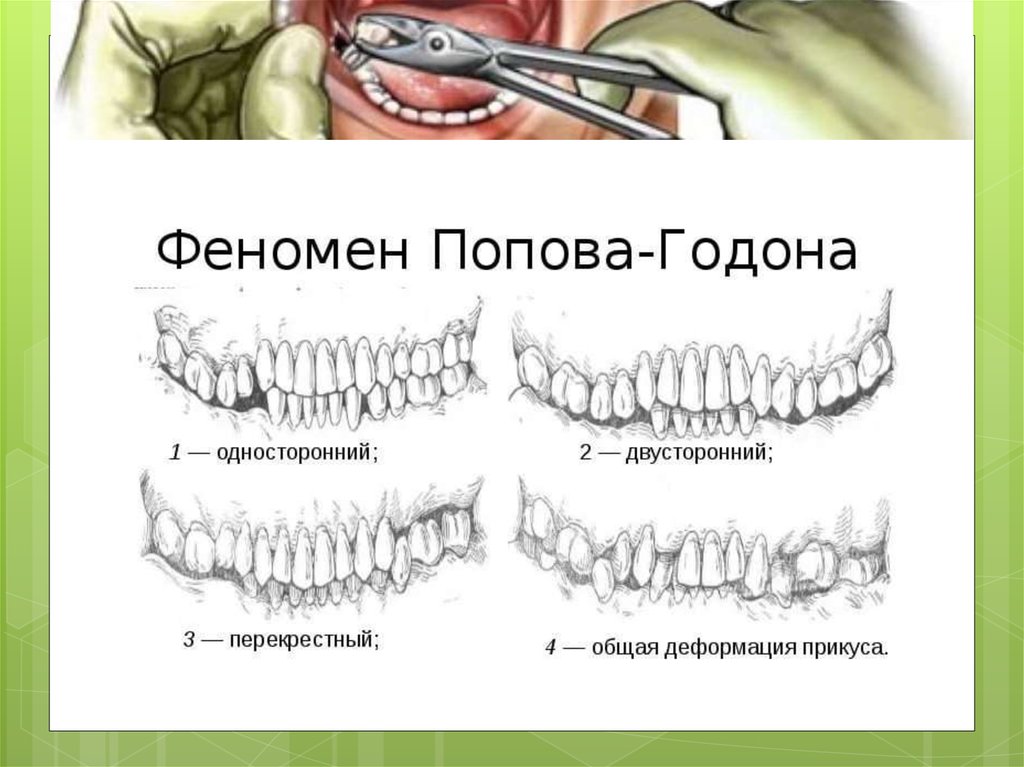 Классификация пономарева