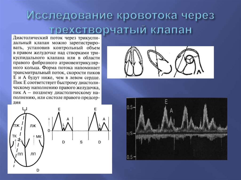 Измерение кровотока. Исследование кровотока. Скорость на трикуспидальном клапане. Скорость кровотока на митральном клапане. Скорость кровотока на трикуспидальном клапане.