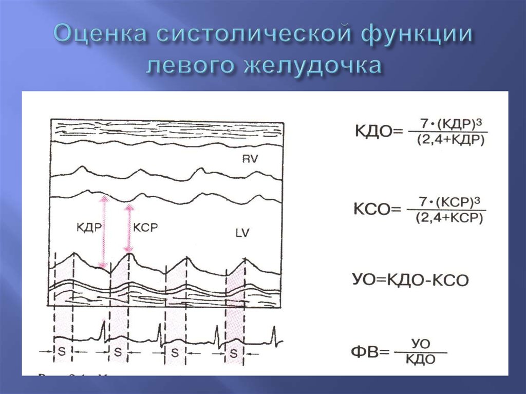 Кдр левого желудочка. Оценка систолической функции лж. Оценка функции левого желудочка. Систолическая функция левого желудочка. Систолическая функция ЭХОКГ.