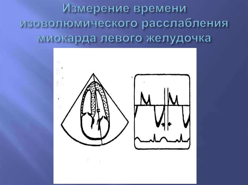 Функции левого желудочка. Изоволюметрического расслабления левого желудочка. Время изоволюмического расслабления левого желудочка. Изоволюмическое расслабление. Расслабление миокарда.