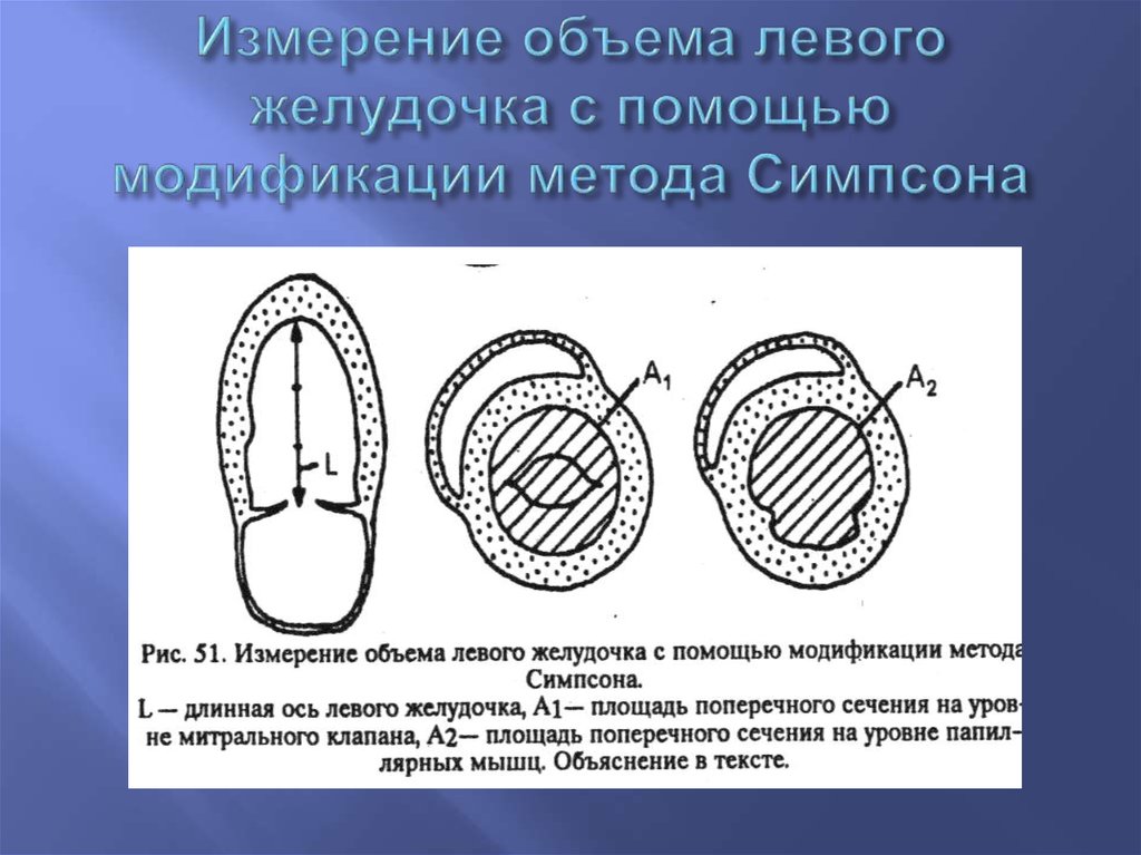 Масса левого желудочка. Измерения левого желудочка. Измерение фракции выброса по Симпсону. Объем левого желудочка. Методы определения фракции выброса левого желудочка.