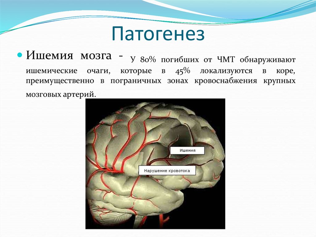 Очаг ишемии мозга. Этиология черепно-мозговой травмы. Патогенез черепно-мозговой травмы. Патогенез сотрясения головного мозга. Патогенез травмы мозга.
