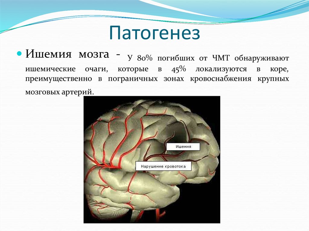 Патогенез черепно-мозговой травмы. Патогенез ЧМТ. Патогенез сотрясения. Патогенез отека мозга при ЧМТ.