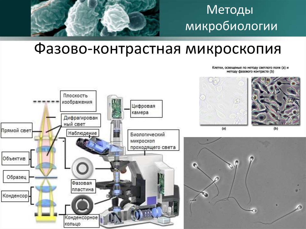 Микроскопией называют метод микроскопии. Фазово-контрастная микроскопия микробиология. Принцип работы фазово контрастного микроскопа микробиология. Фазово-контрастная микроскопия принцип метода. Фазово-контрастная микроскопия бактерии.