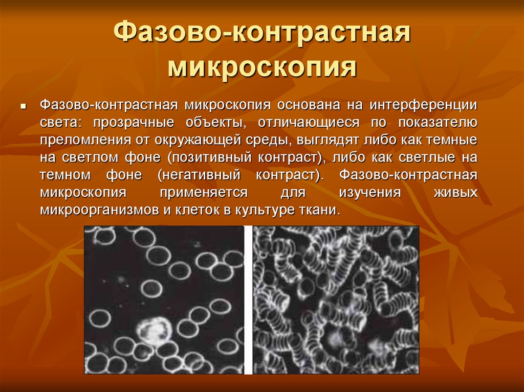 Применение метода микроскопии. Фазово-контрастная микроскопия микробиология. Принцип работы фазово контрастного микроскопа микробиология. Фазово-контрастная микроскопия принцип. Позыва контрастная микроскопии.