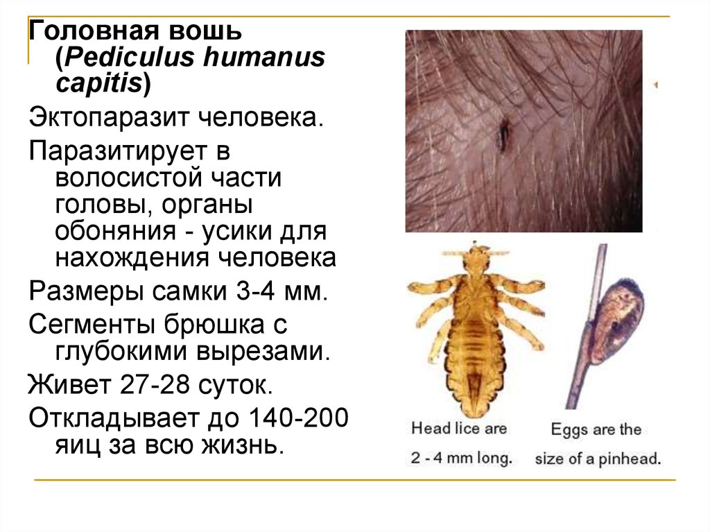 Какой цифрой обозначено на рисунке яйцо головной вши