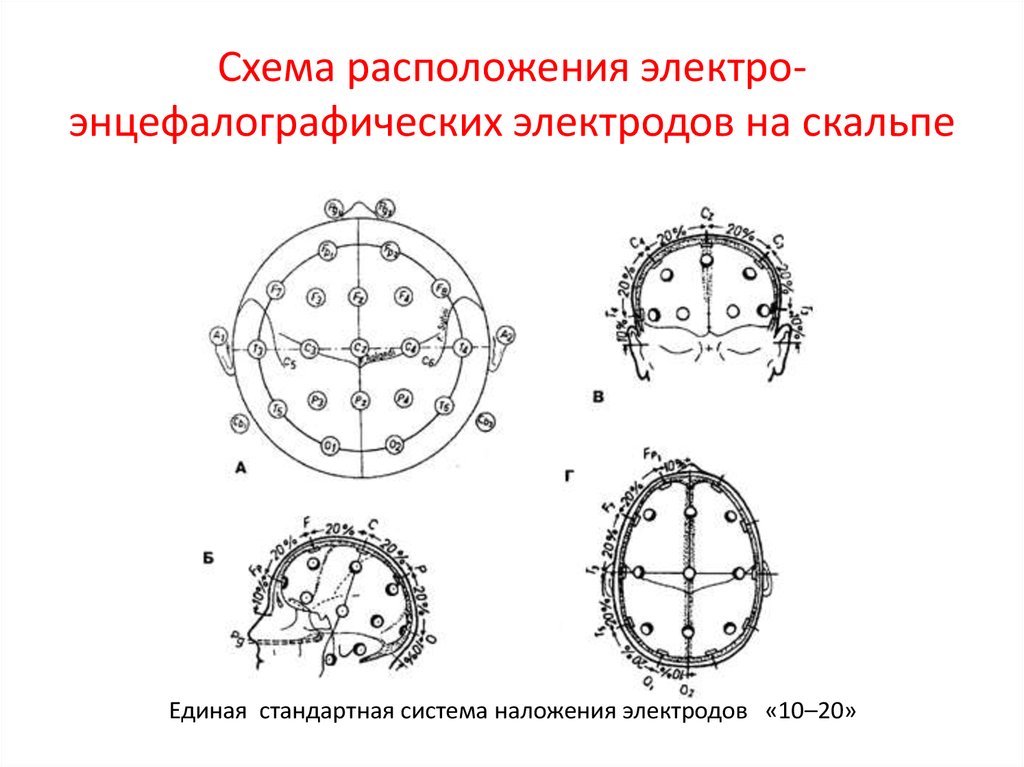 Схема расположения электродов