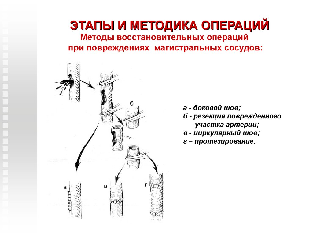 Рассмотрите рисунок с изображением повреждений кровеносных сосудов какой