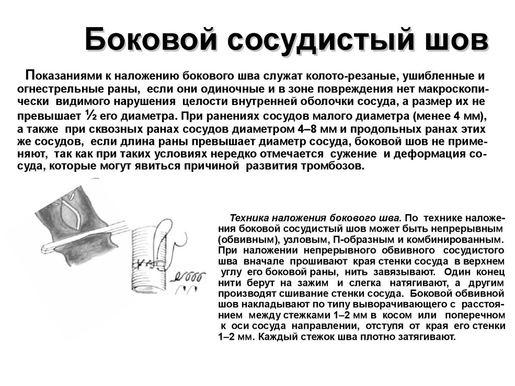 Сосудистый шов топографическая анатомия презентация