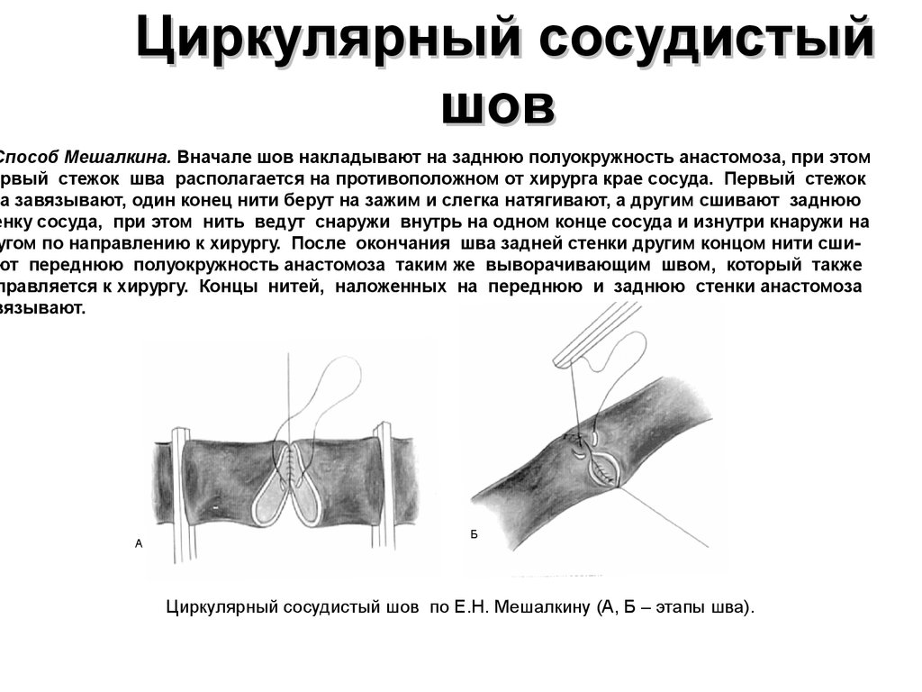 Шов артерий