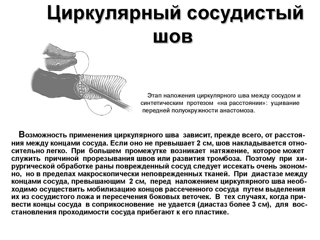 Сосудистый шов методы наложения. Показания к наложению сосудистого шва. Циркулярный сосудистый шов. Методика наложения сосудистого шва. Боковой и циркулярный сосудистые швы.