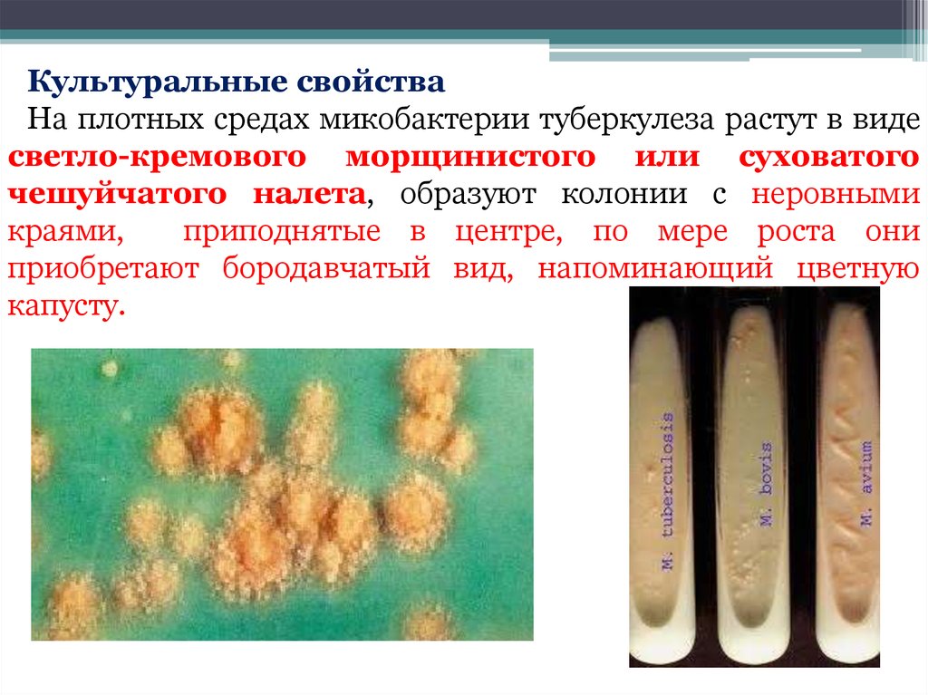 Свойства микобактерий. Микобактерии туберкулеза на среде Левенштейна Йенсена. Среда Левенштейна-Йенсена туберкулез. Микобактерия туберкулеза на среде Левенштейна. Микобактерии туберкулёза питательнач среда.