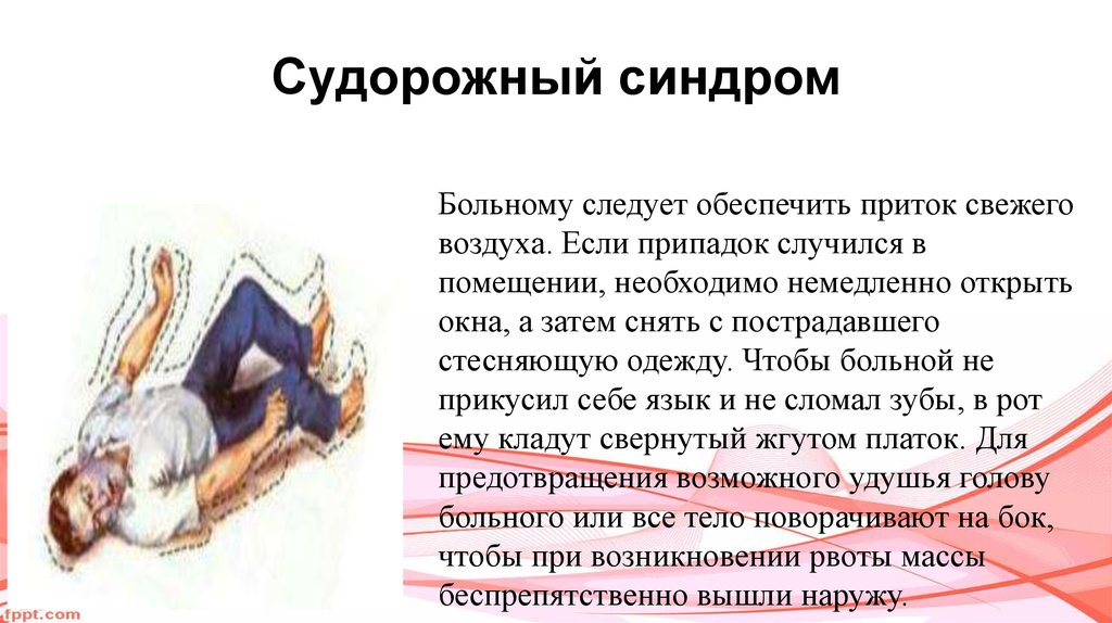 Судорожный синдром