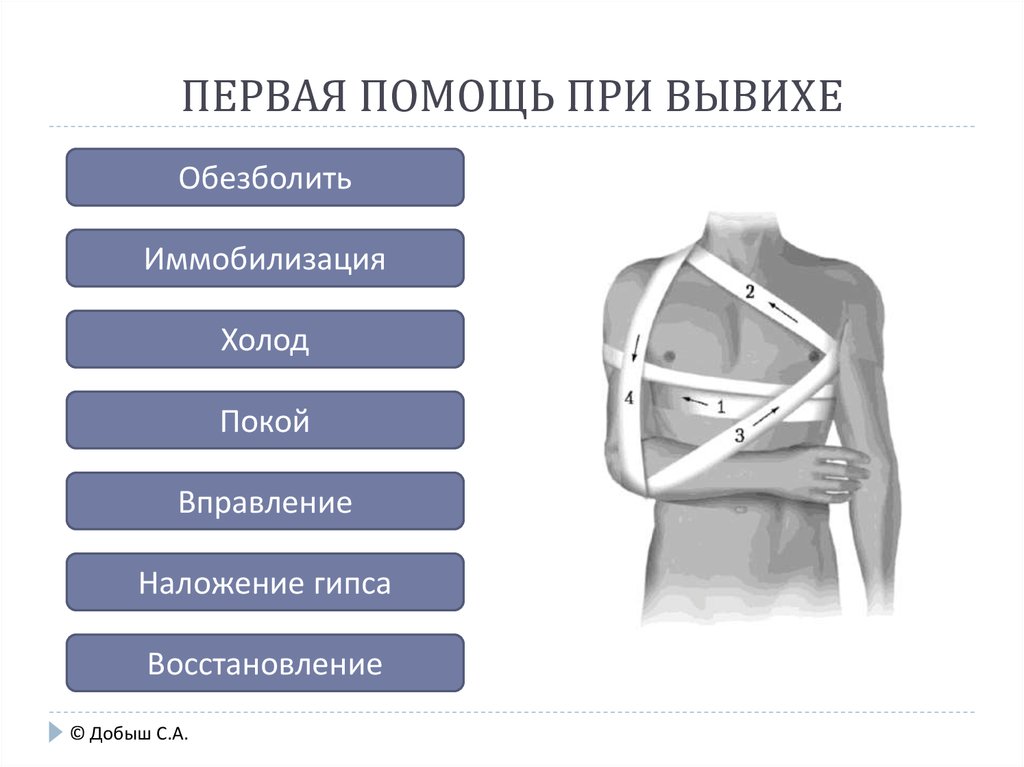 Правила помощи при вывихе