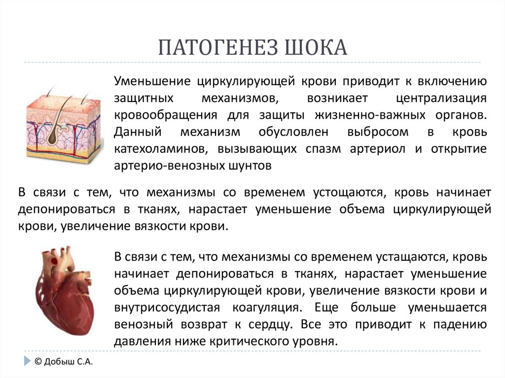 Патогенез шока. ШОК этиология патогенез. Общий патогенез шока. Патогенез шока патофизиология.