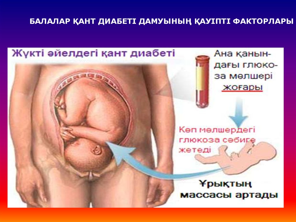 Положили на сохранение беременности. Гестационный диабет плод большой. Гестационный сахарный диабет плод. Крупный плод при беременности. Крупный плод при беременности при ГСД.