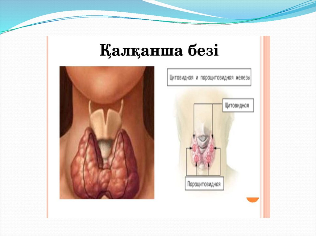 Ішкі секреция бездері аурулары презентация