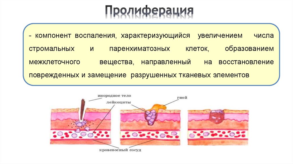 Воспаление патофизиология презентация