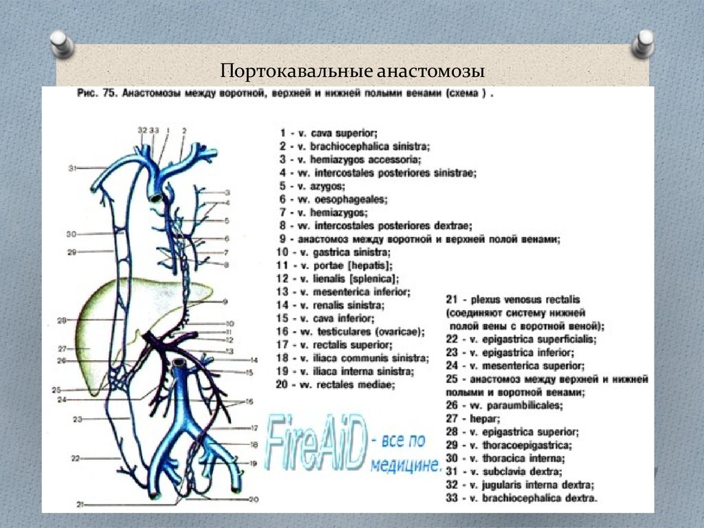 Портокавальные анастомозы презентация