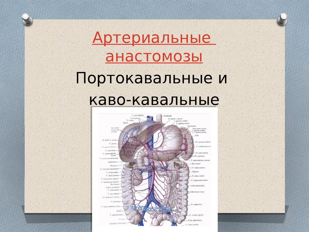 Портокавальные анастомозы презентация