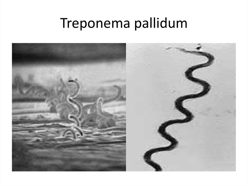 Бледная трепонема treponema pallidum. Спирохета бледная трепонема. Бледная спирохета микробиология.