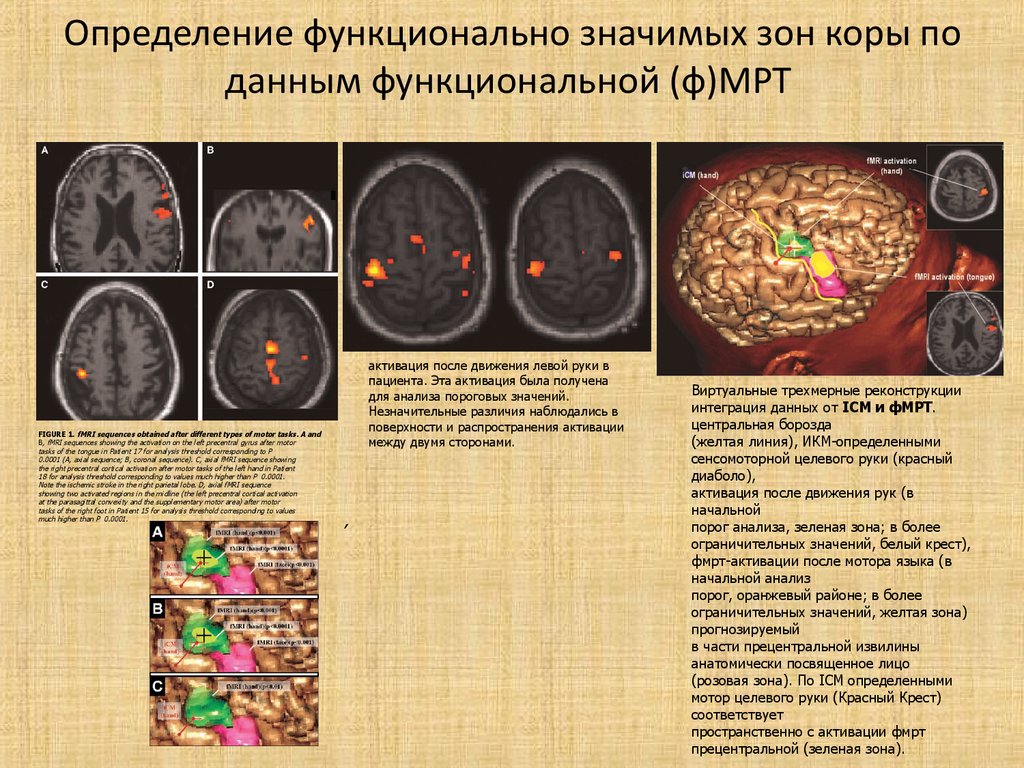 Функциональная мрт презентация