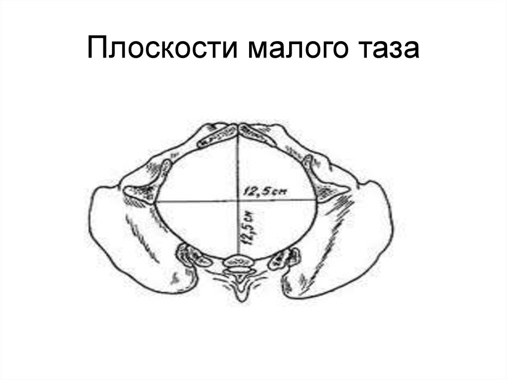 Плоскости таза. Плоскость широкой части полости малого таза. Плоскость входа в малый таз. Женский малый таз. Плоскости малого таза женщины.