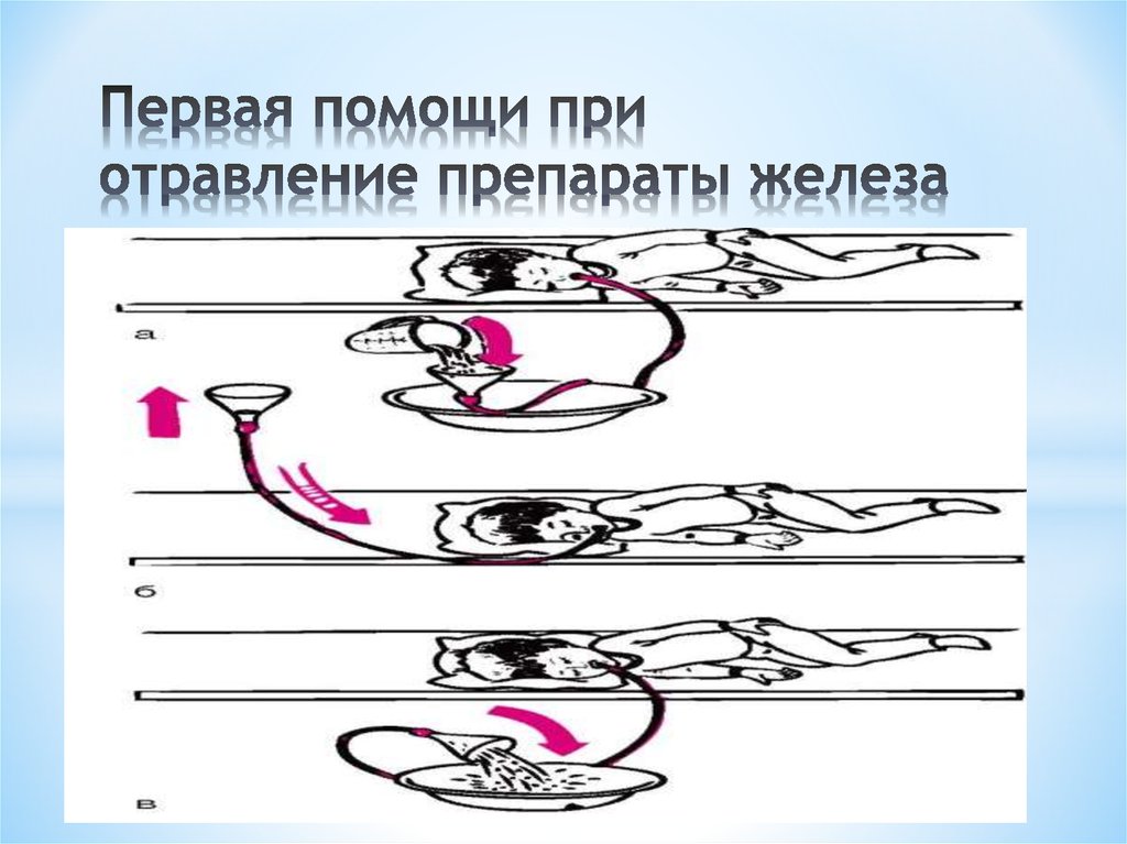 Первая помощи при отравление препараты железа