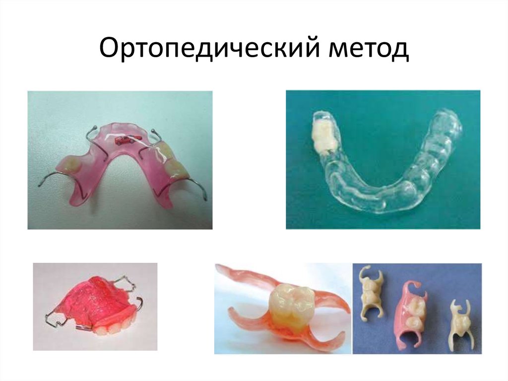 Функциональные методы диагностики в ортодонтии презентация