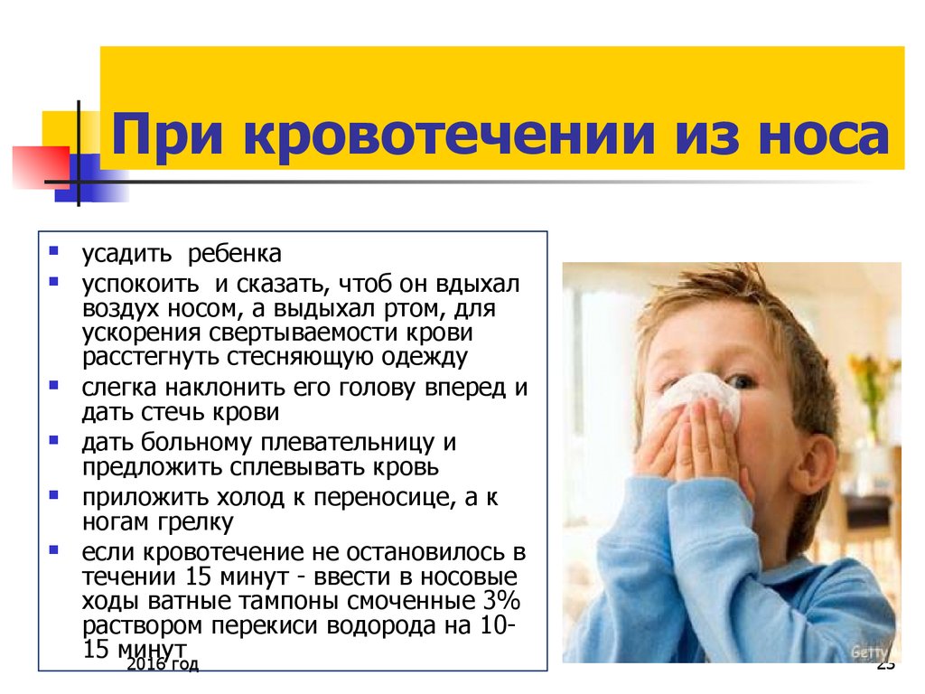 Кровь носом у ребенка 8 лет причины. Причины кровотечения из носа у детей. Идёт кровь из носа причины. Кровь из носа у ребенка причины. Почему мдеь кровь из роса.