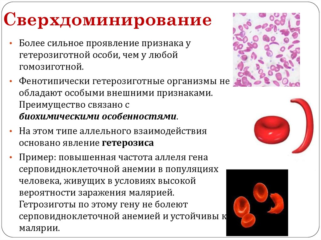 Ген серповидноклеточной анемии. Серповидно-клеточная анемия человека. Сверхдоминирование. Сверхдоминирование примеры. Пример сверхдоминирования у человека.