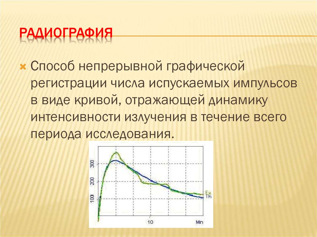 Радиография