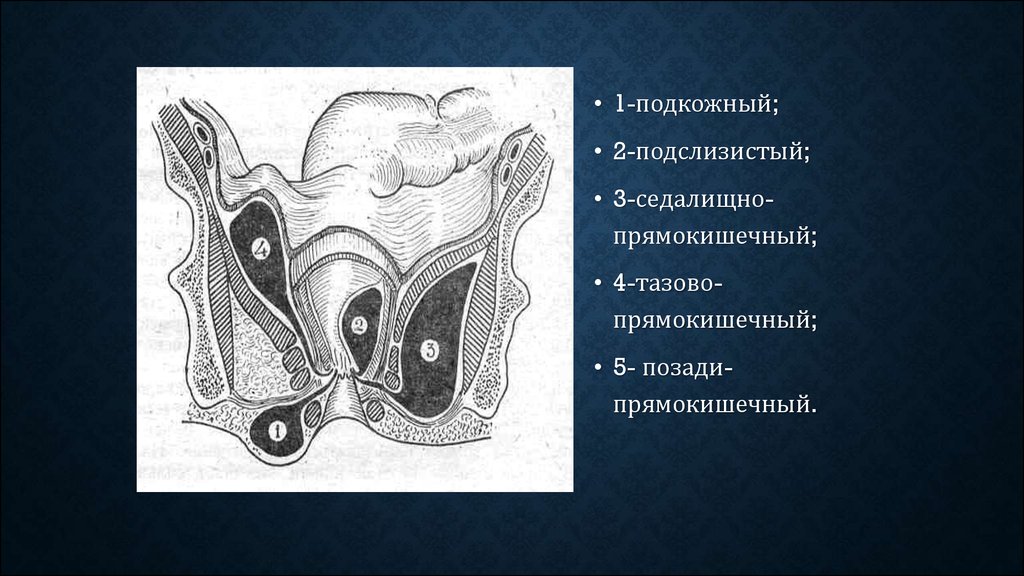 Хронический парапроктит презентация