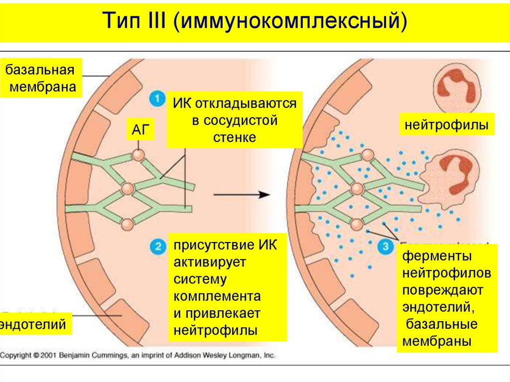 Сывороточная болезнь презентация