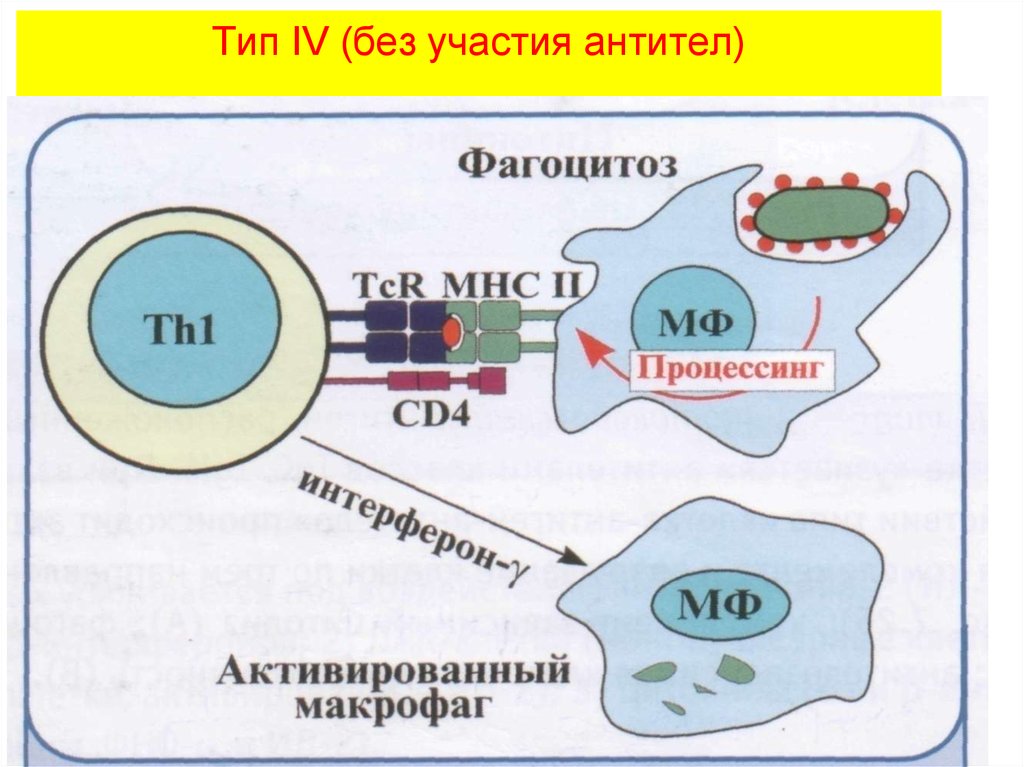 Реакции гиперчувствительности картинки