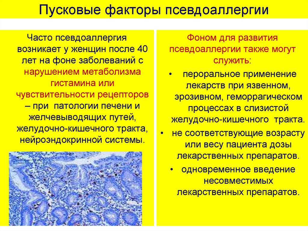 Псевдоаллергические реакции презентация