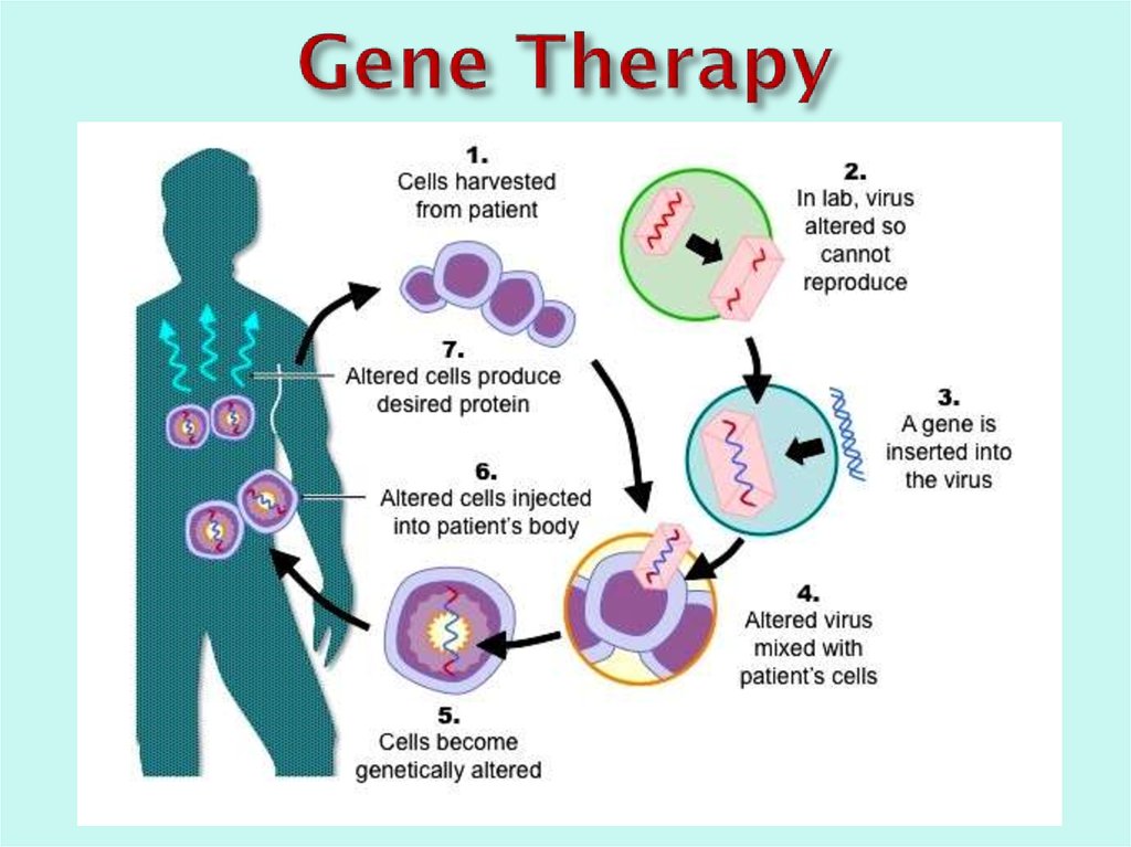 Gene Therapy