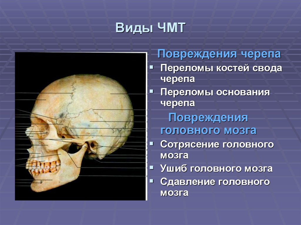 Перелом основания черепа карта вызова