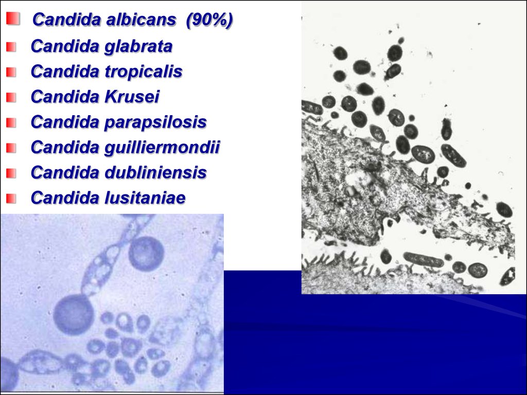 Candida albicans лечение. Candida parapsilosis микроскопия. Candida glabrata норма.